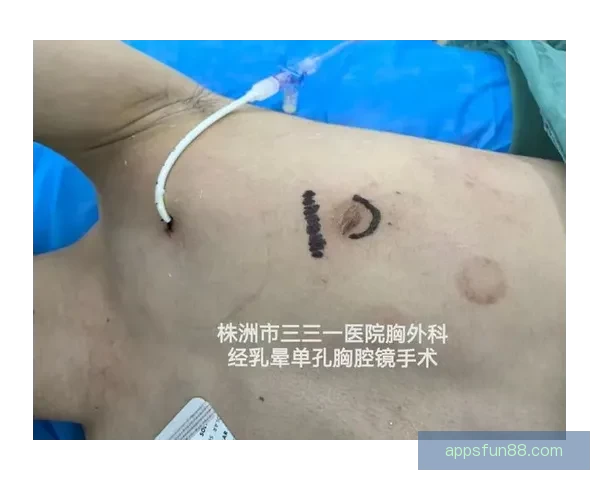 坎宁安气胸康复持续推进 活塞计划一周后复查评估